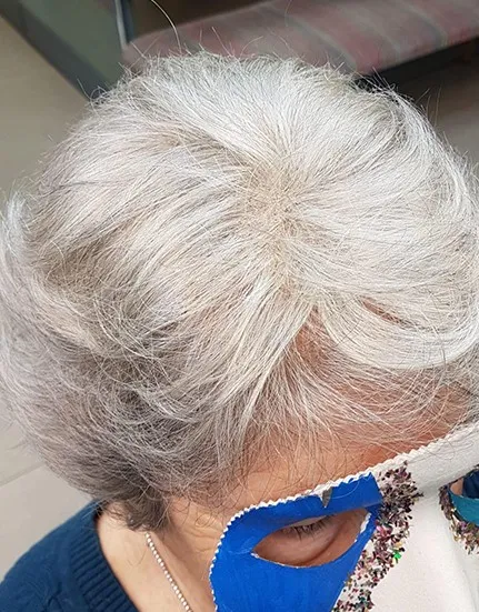 טופרס | אלי כהן אמן הפאות - פתרונות לדלילות שיער