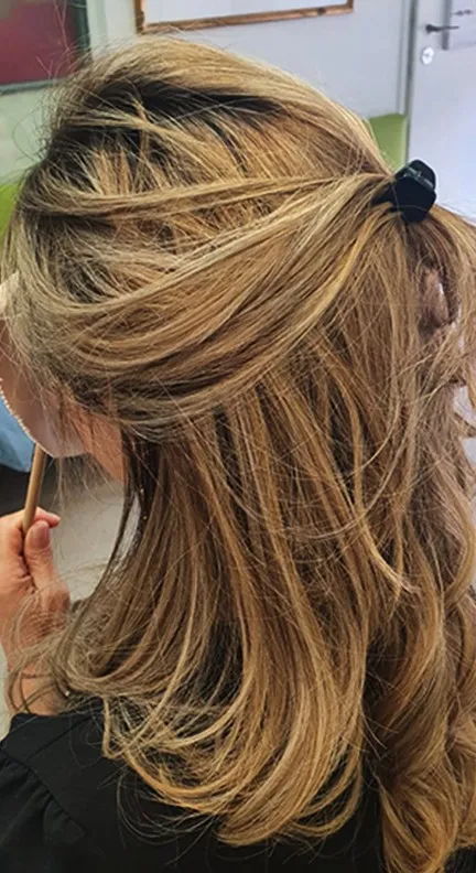 פאה מדולרית לחולת סרטן