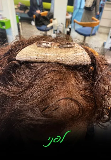 תוספת מיקרוליינס | אלי כהן - המרכז לפתרונות שיער