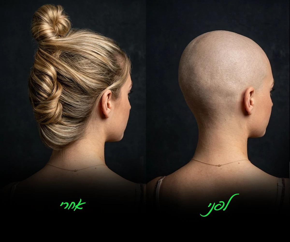 לפני ואחרי — פאה בהתאמה אישית